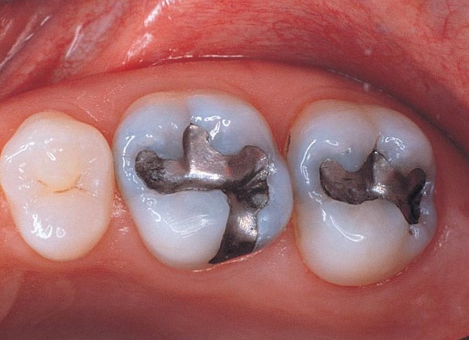 دندانپزشکی ترمیمی