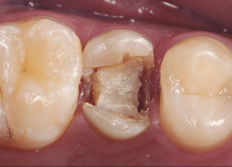 مشکلات دهان و دندان