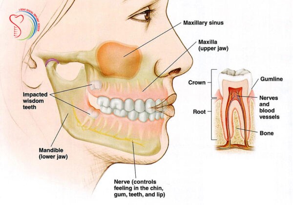 درمان درد دندان سینوسی 