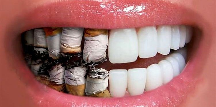 عوارض استعمال دخانیات از جمله سیگار برای سلامت دهان و دندان