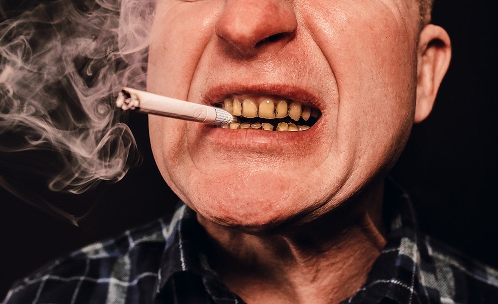 تاثیر سیگار روی تغییر رنگ دندان ها