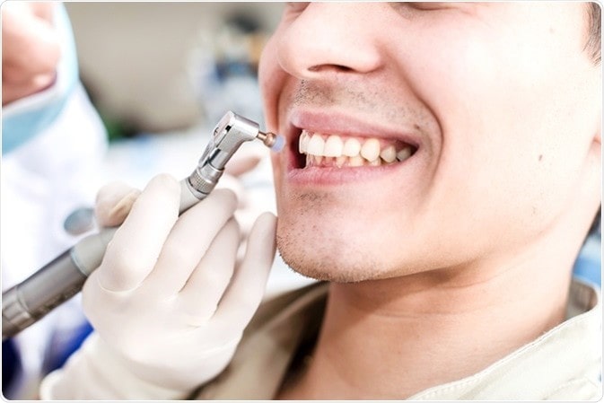 پولیش کامپوزیت دندان خوب چه ویژگی هایی دارد؟
