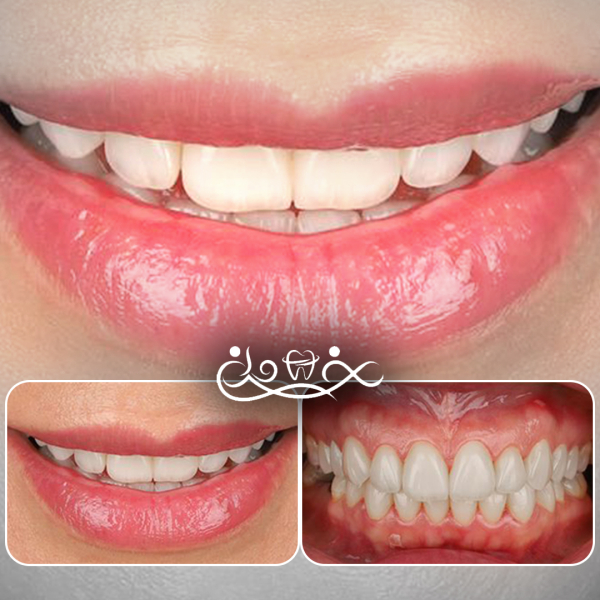 🦷 زیبایی لبخند حق شماست 💎