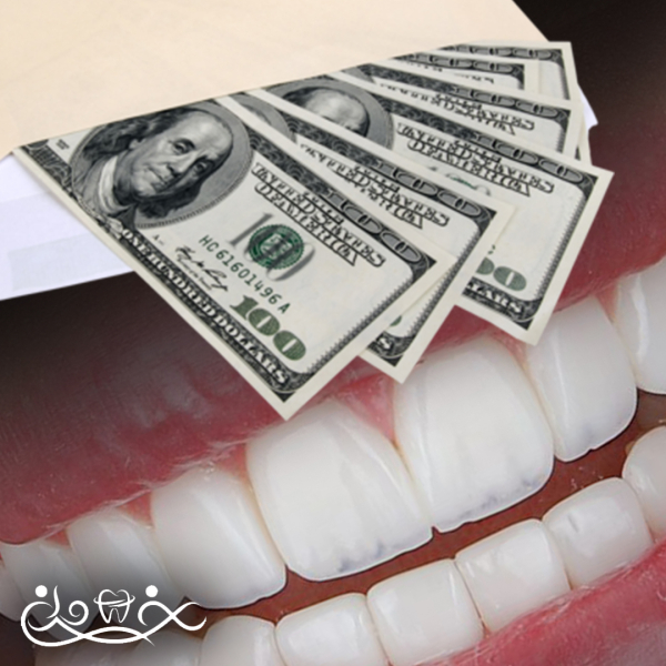 مزیت استفاده از برند خوب کامپوزیت در مقایسه با کامپوزیت ارزان و نامرغوب