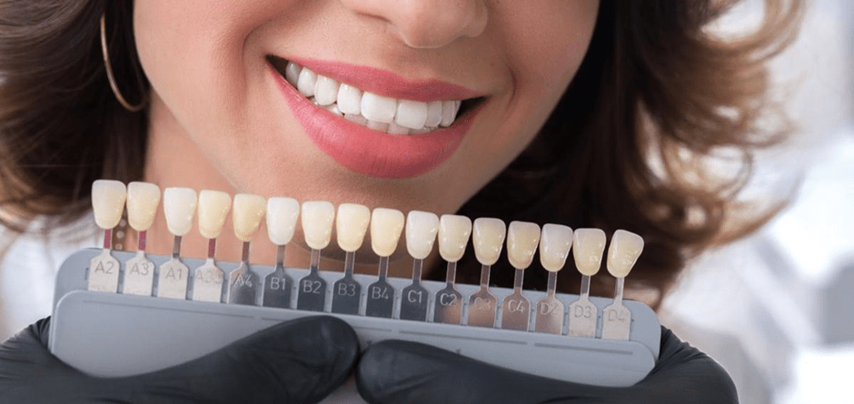 کامپوزیت دندان و کاربردهای آن