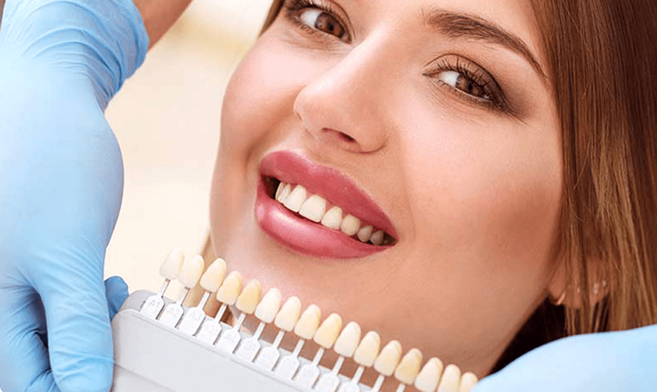 فاکتورهای مهم در پرداخت اقساط کامپوزیت دندان