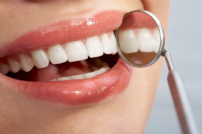 راه ‌های جلوگیری از درد بعد از بلیچینگ دندان