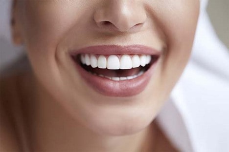 آیا لمینت و پوسیدگی دندان با یکدیگر ارتباط دارند؟