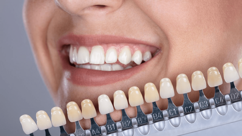 شیوه درمانی کامپوزیت دندان مناسب چه افرادی است؟