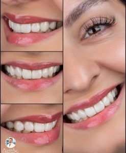 چگونه بهترین دندانپزشک زیبایی زعفرانیه را انتخاب کنیم؟ ✅