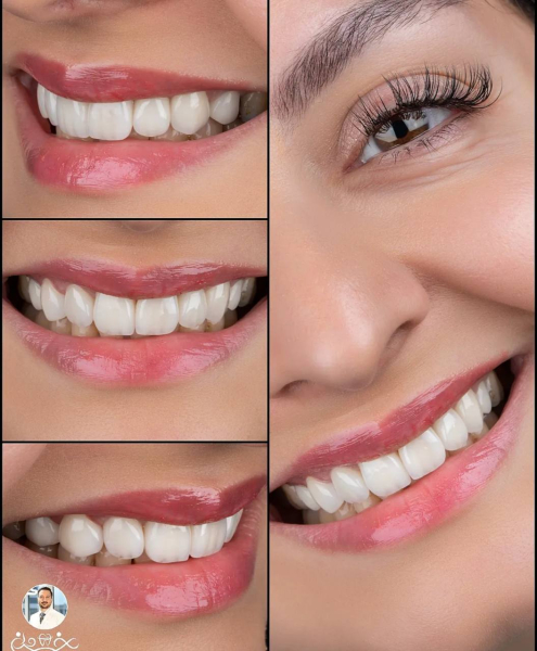 چگونه بهترین دندانپزشک زیبایی زعفرانیه را انتخاب کنیم؟ ✅
