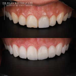دندانپزشک زیبایی در زعفرانیه؛ لبخندی ماندگار در دل تهران