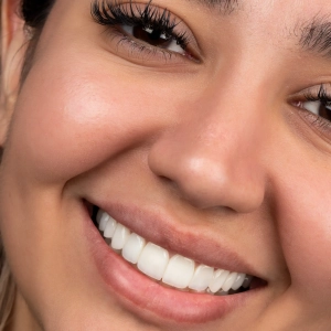 دندانپزشک زیبایی در زعفرانیه؛ لبخندی ماندگار در دل تهران