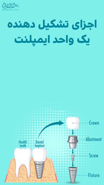 ایمپلنت دندان چیست؟