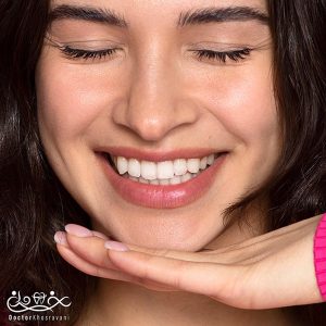 بلیچینگ دندان در ولنجک — تجربه درخشندگی لبخند در دستان متخصص زیبایی دندان