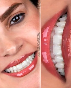 چرا بیماران خاص، تصمیم عجولانه نمیگیرند؟