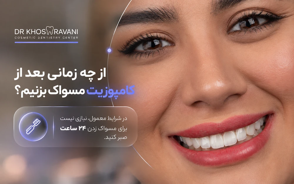 از چه زمانی بعد از کامپوزیت مسواک بزنیم؟